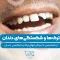 S92-ترک ها و شکستگی های دندان از تشخیص تا درمان 1