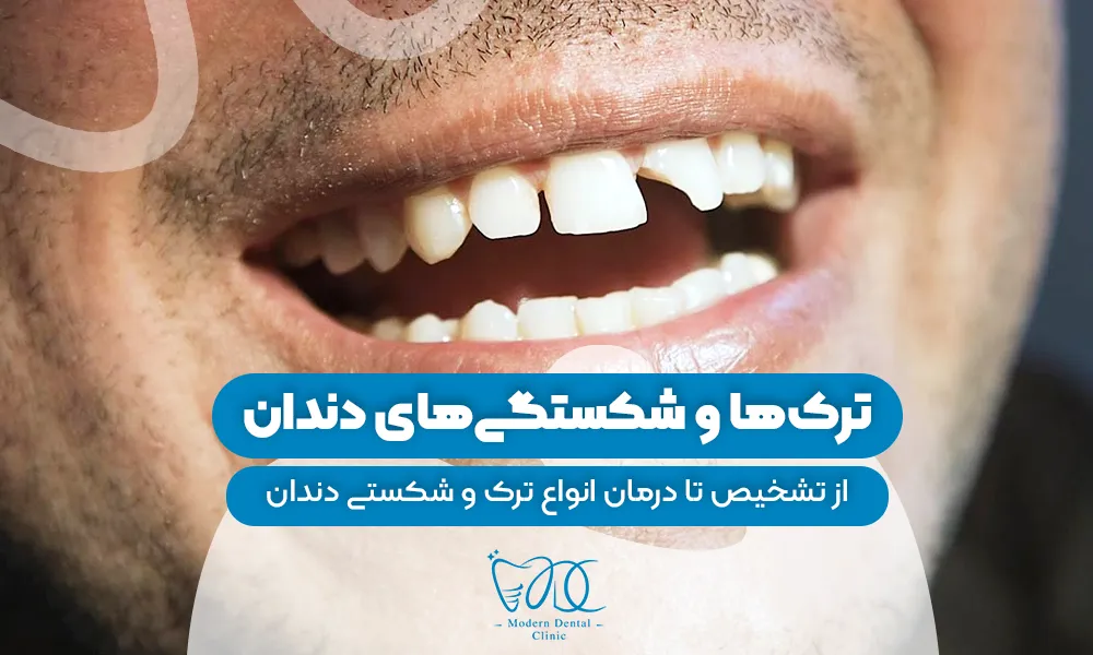 تصویر پیش بار گذاری
