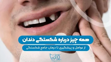 S92- شکستگی دندان علل، پیشگیری و درمان جامع 1