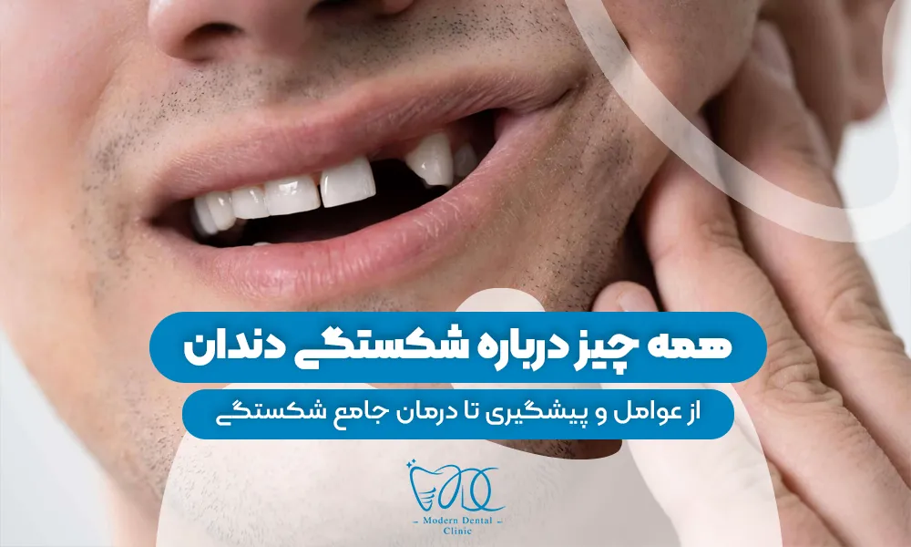 تصویر پیش بار گذاری