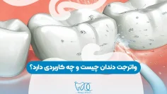 What is dental waterjet
