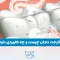 What is dental waterjet