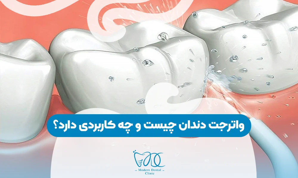 تصویر پیش بار گذاری