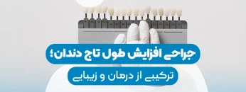 Dental crown lengthening surgery-11