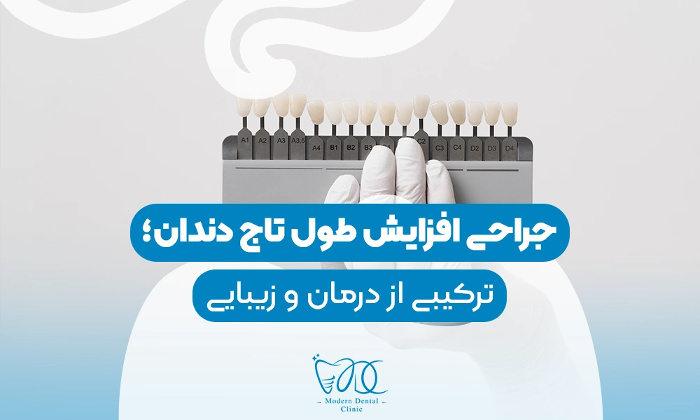 تصویر پیش بار گذاری
