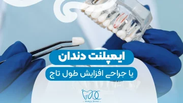 Implants or crown lengthening surgery-1