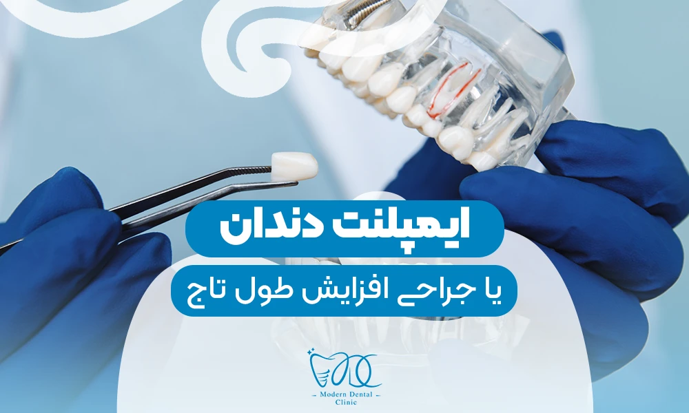 تصویر پیش بار گذاری
