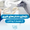 Reconstruction of baby teeth-1