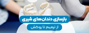 Reconstruction of baby teeth-1