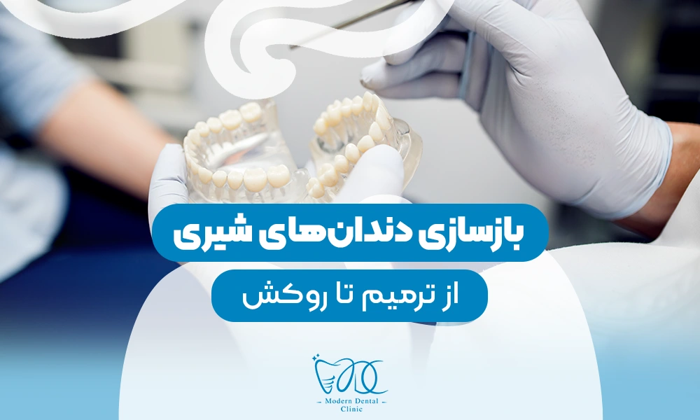 تصویر پیش بار گذاری
