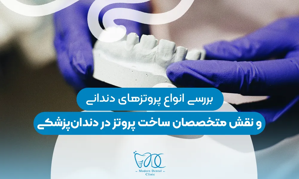 تصویر پیش بار گذاری