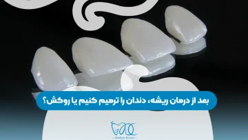 Should we restore the tooth or get a crown-0