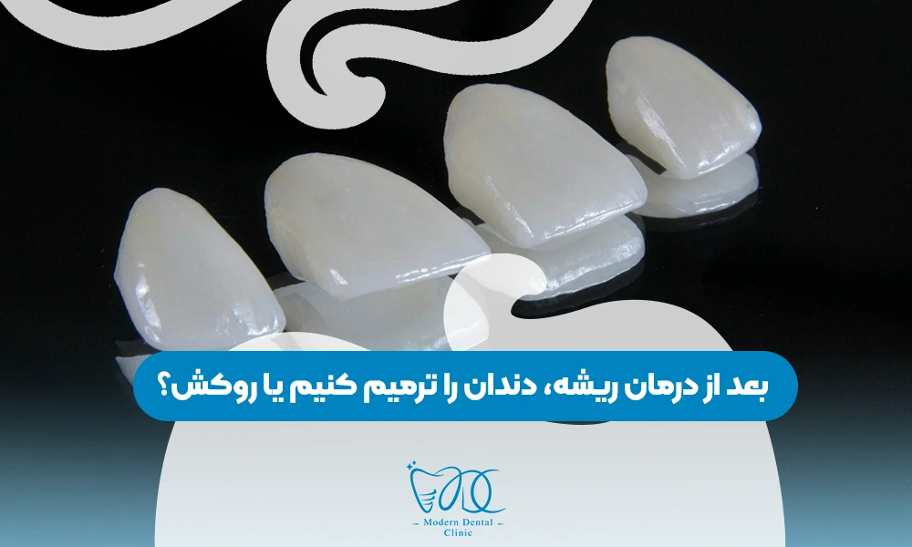 تصویر پیش بار گذاری