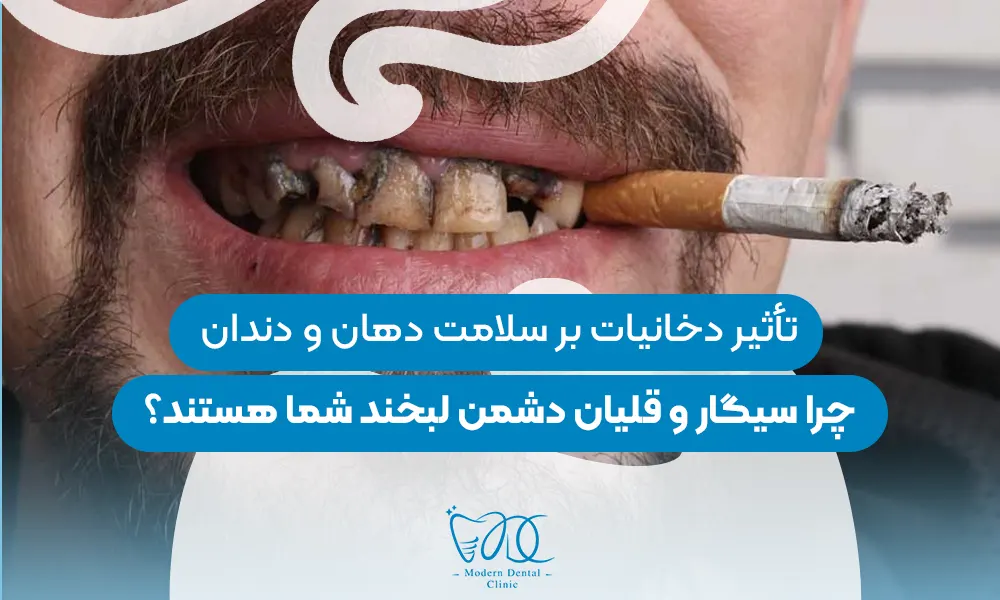 تصویر پیش بار گذاری