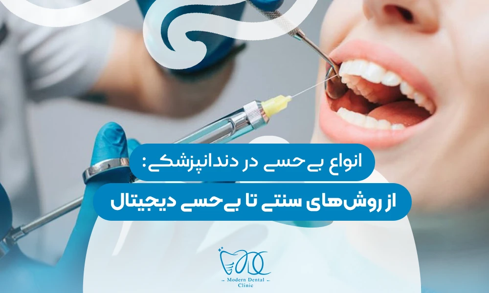 تصویر پیش بار گذاری