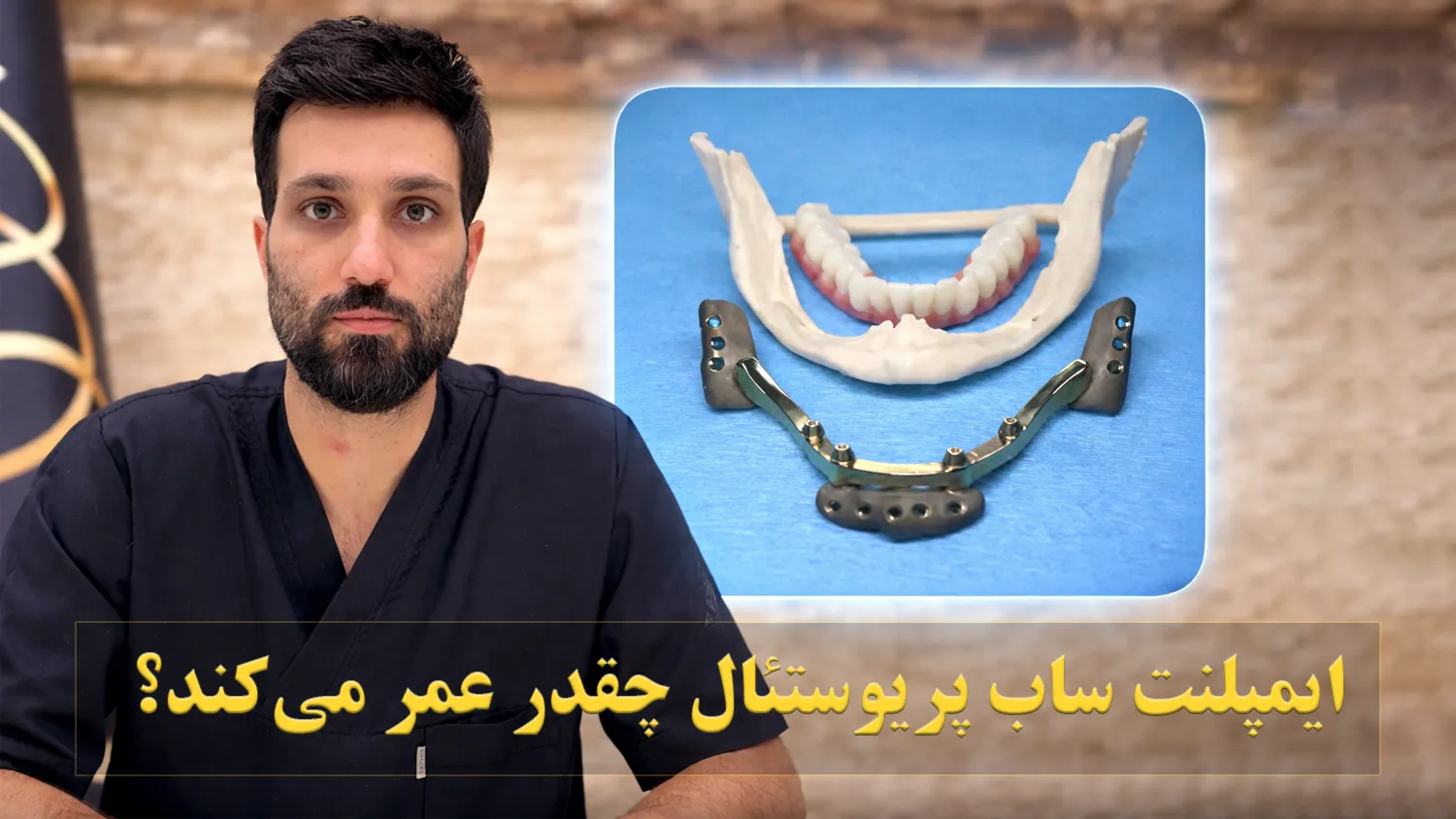 تصویر پیش بار گذاری